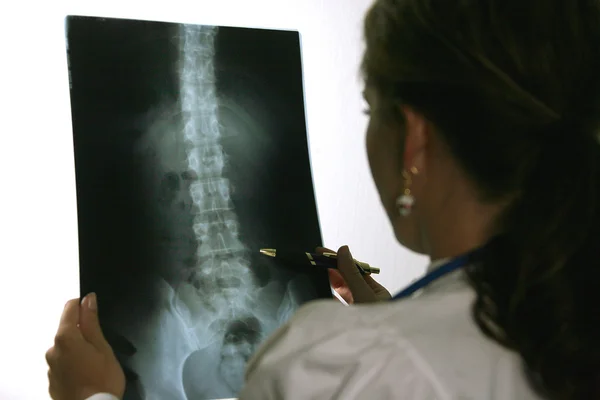 En läkare på sjukhuset med röntgen — Stockfoto