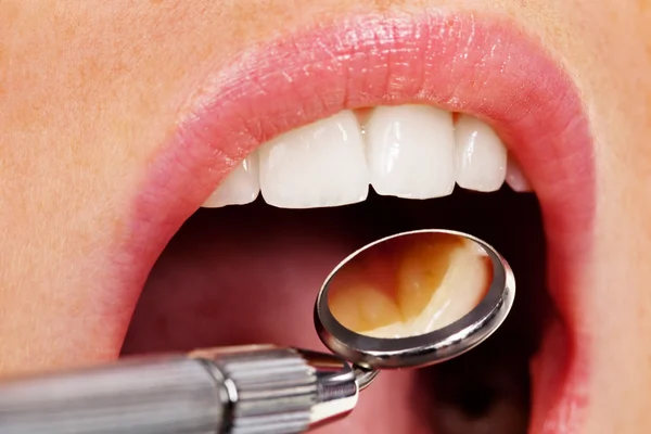 Der Zahnarzt — Stockfoto