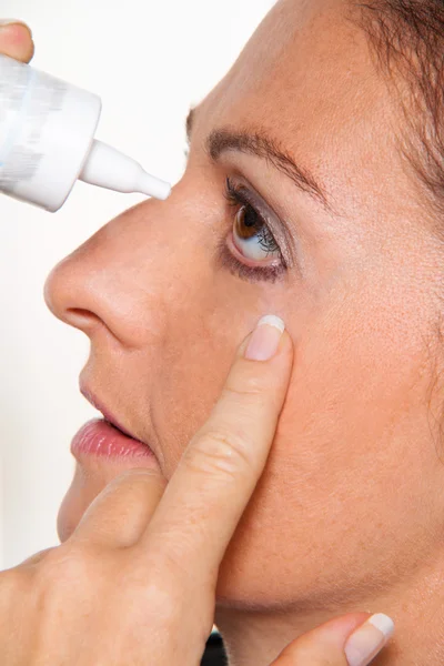 Женщина с глазными каплями и аллергией. сенная лихорадка — стоковое фото