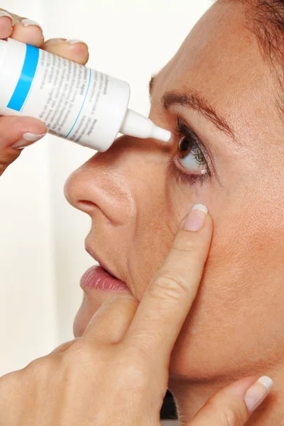 Frau mit Augentropfen und Allergie. — Stockfoto