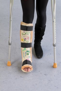 Woman with leg in plaster and crutches in hospital clipart