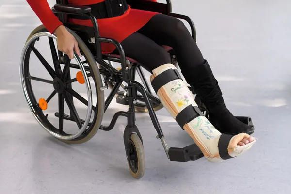 Mujer con pierna en yeso — Foto de Stock