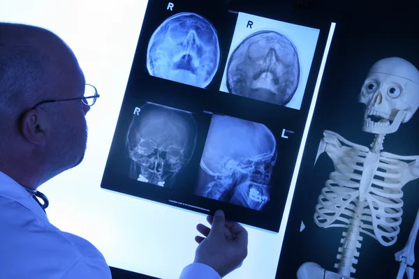 Доктор проверяет рентген — стоковое фото