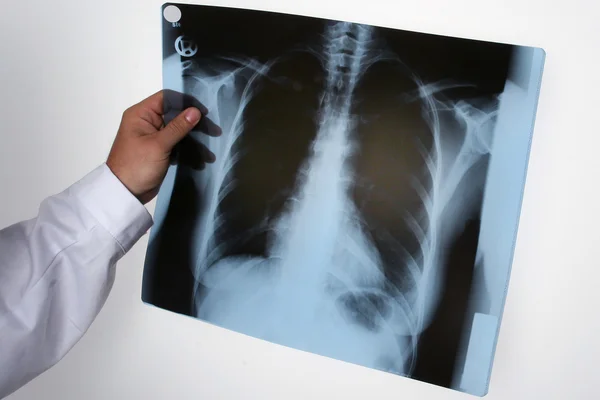 Doctor checking X-Ray — Stock Photo, Image