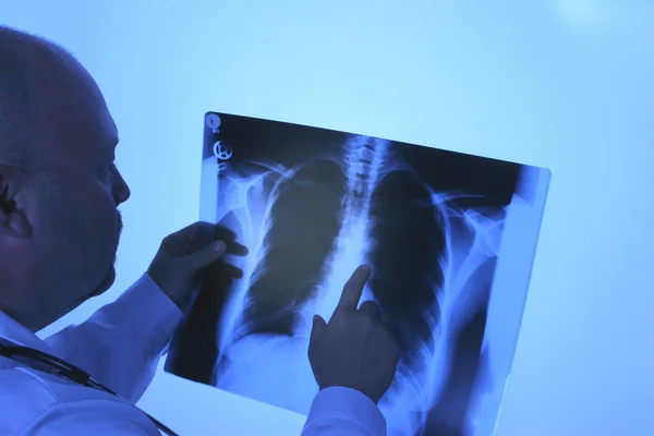 X 線検査の医者 — ストック写真