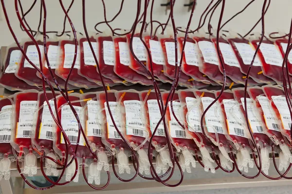Blod fra donorblod i blodlaboratoriet – stockfoto