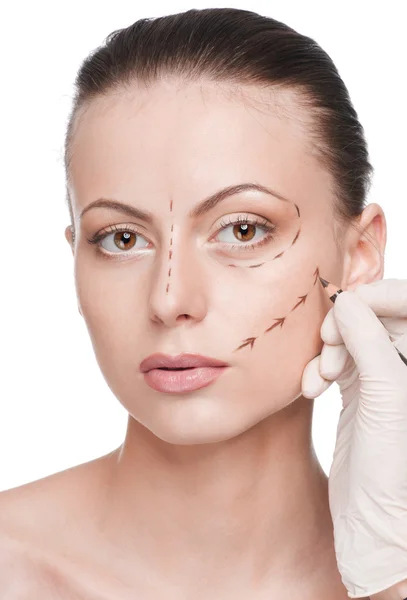 stock image Correction lines on woman face, before surgery operetion