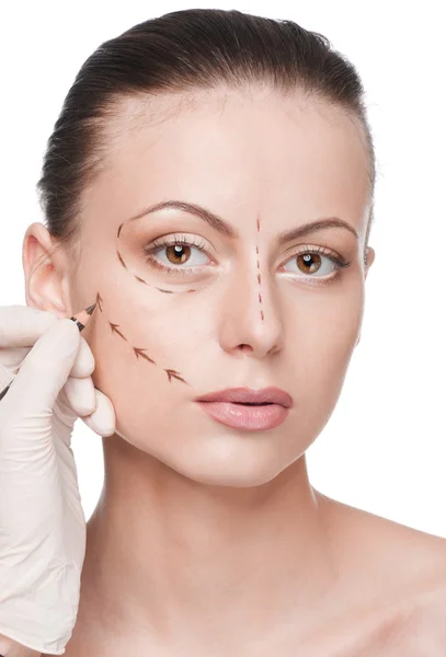 Korrigeringsrader på kvinna ansikte, innan kirurgi operetion — Stockfoto