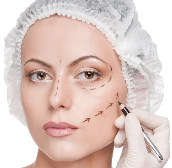 Líneas de corrección en la cara de la mujer, antes de la operación quirúrgica — Foto de Stock
