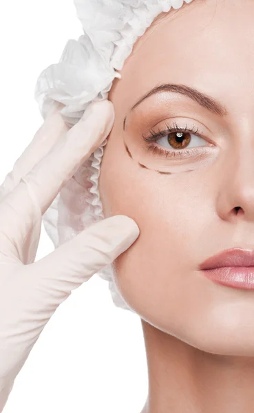 Correction lines on woman face, before surgery operetion — Stock Photo, Image