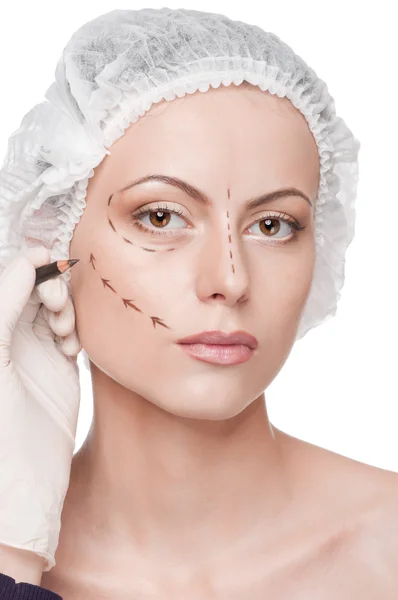 Líneas de corrección en la cara de la mujer, antes de la operación quirúrgica —  Fotos de Stock
