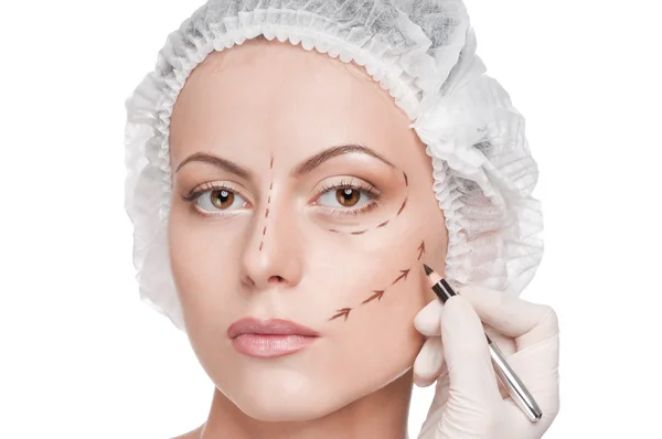 Linhas de correção no rosto da mulher, antes da cirurgia operetion — Fotografia de Stock