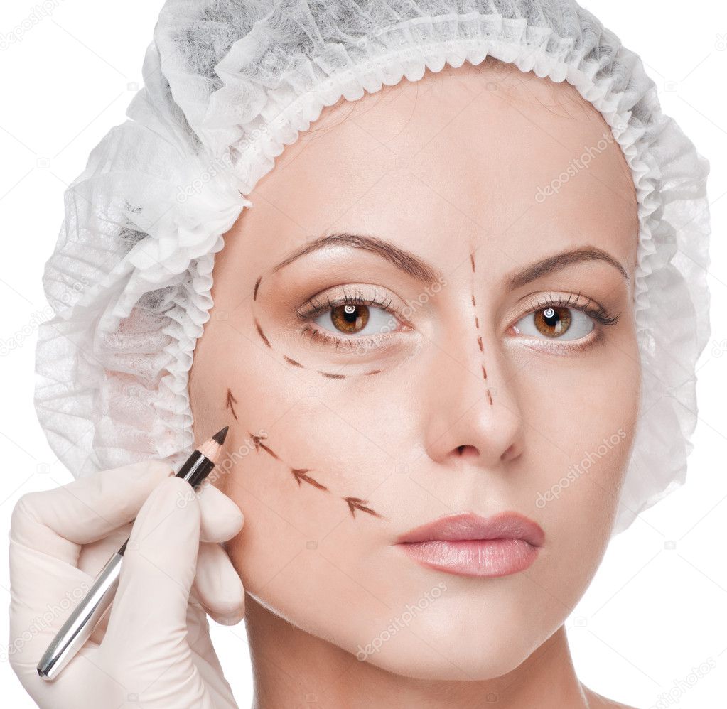 Correction lines on woman face, before surgery operetion