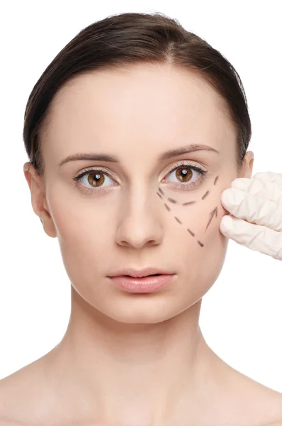 Líneas de corrección en la cara de la mujer, antes de la operación quirúrgica —  Fotos de Stock