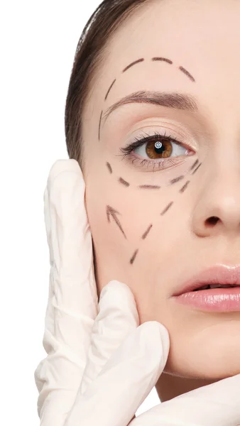 Korrigeringsrader på kvinna ansikte, innan kirurgi operetion — Stockfoto