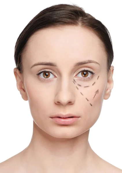 Linee di correzione sul viso della donna, prima dell'intervento chirurgico — Foto Stock