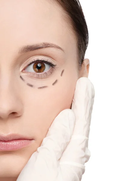 Correction lines on woman face, before surgery operetion — Stock Photo, Image