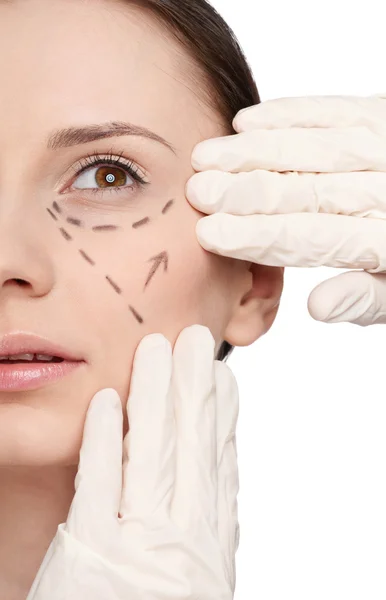 Líneas de corrección en la cara de la mujer, antes de la cirugía — Foto de Stock