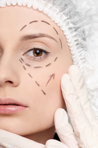 Linhas de correção no rosto da mulher, antes da cirurgia — Fotografia de Stock