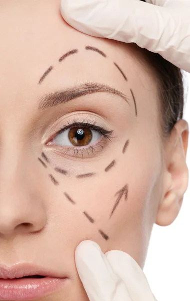 Linhas de correção no rosto da mulher, antes da cirurgia — Fotografia de Stock