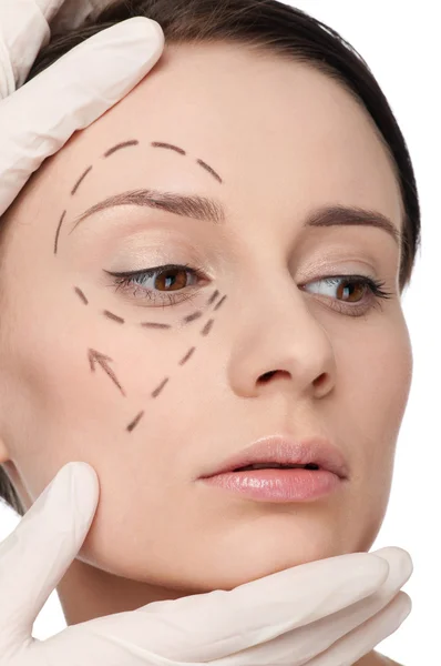 Linhas de correção no rosto da mulher, antes da cirurgia operetion — Fotografia de Stock
