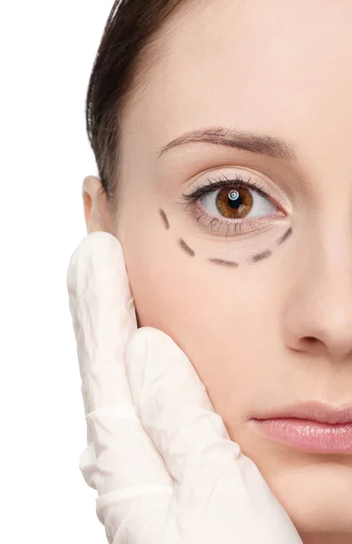 Correction lines on woman face, before surgery operetion — Stock Photo, Image