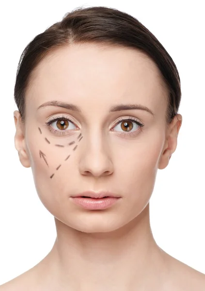 Líneas de corrección en la cara de la mujer, antes de la operación quirúrgica — Foto de Stock