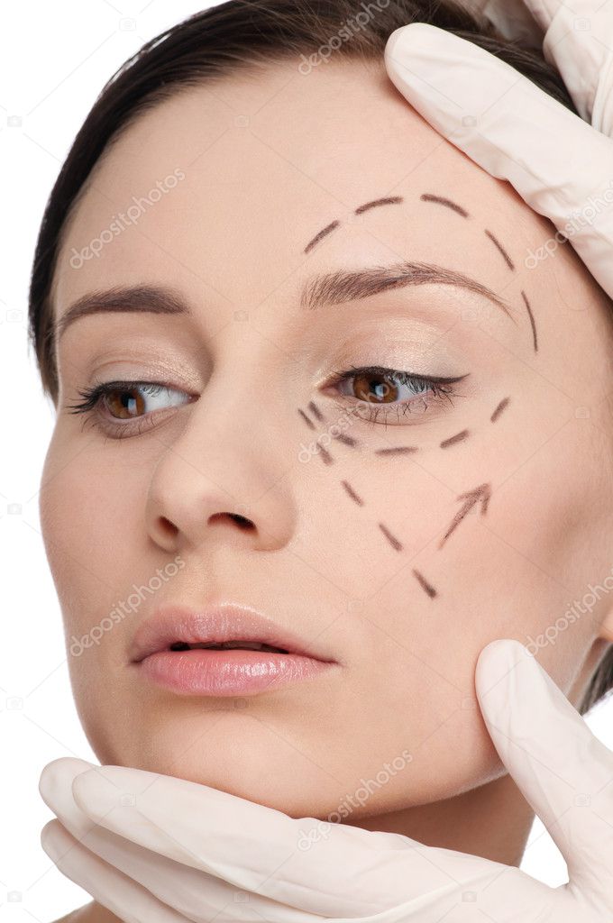 Correction lines on woman face, before surgery operetion
