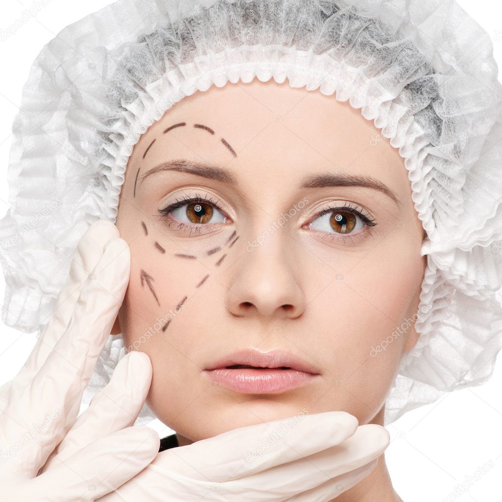 Correction lines on woman face, before surgery operation