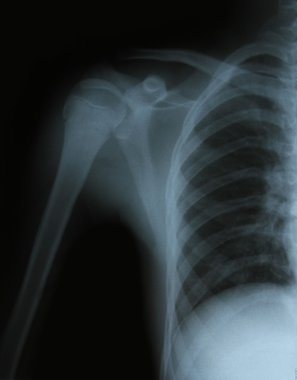 kemikleri x-ray görüntüsü