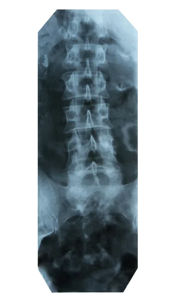 X-ray image of bones — Stock Photo, Image