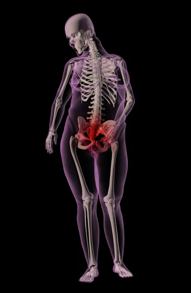 Esqueleto médico de uma mulher com excesso de peso com dor de estômago — Fotografia de Stock