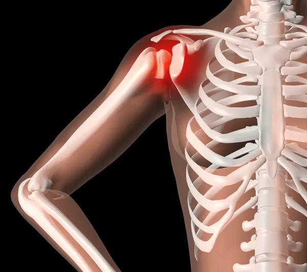 Esqueleto femenino con dolor de hombro — Foto de Stock