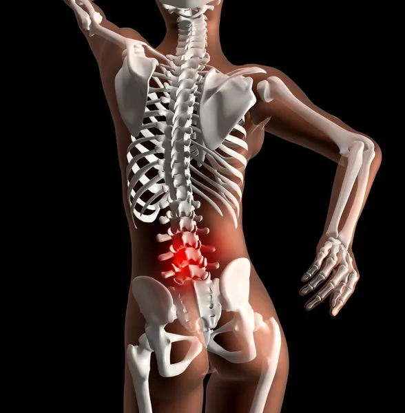 Esqueleto feminino com dor nas costas — Fotografia de Stock
