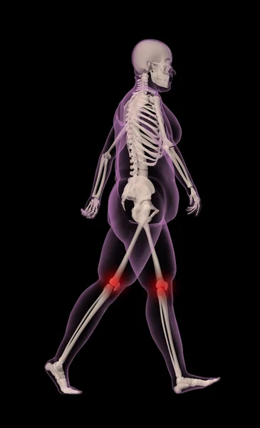 Nadváha, ženské kostry chůzi — Stock fotografie
