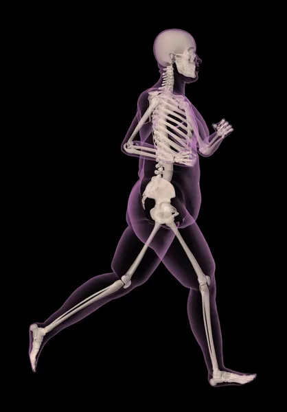 Ιατρική σκελετός μια υπέρβαρη γυναίκα που τρέχει — Φωτογραφία Αρχείου