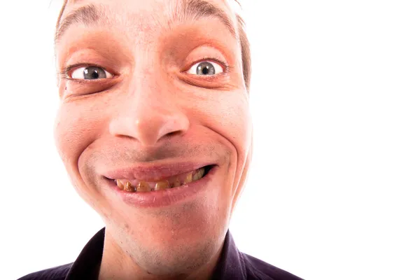Ugly man face - Stock Image. 