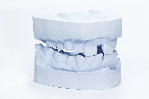 Um conjunto de impressões dentárias adultas — Fotografia de Stock
