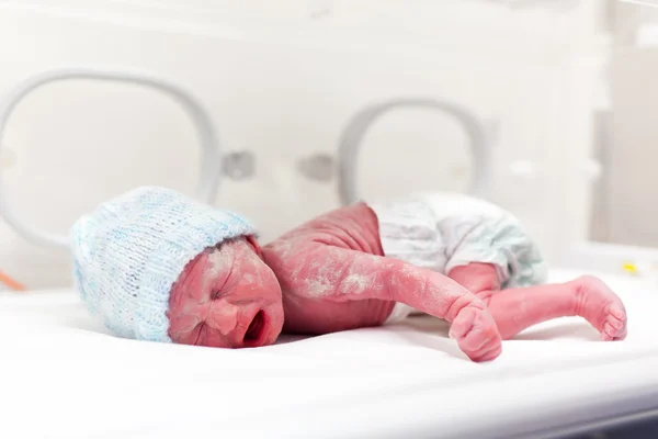 Nowonarodzonego chłopca w vertix w inkubatorze — Zdjęcie stockowe