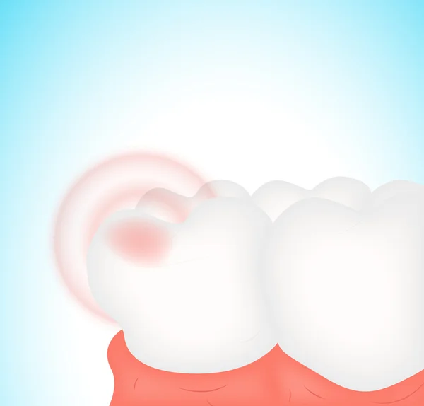 Bolestivý zub — Stockový vektor
