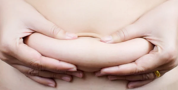 Stomach fat woman body part. — Stock Photo, Image