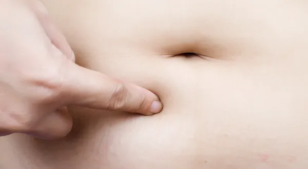 Estômago parte do corpo da mulher gorda . — Fotografia de Stock