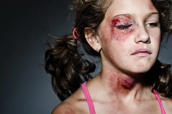 家庭暴力 — 图库照片
