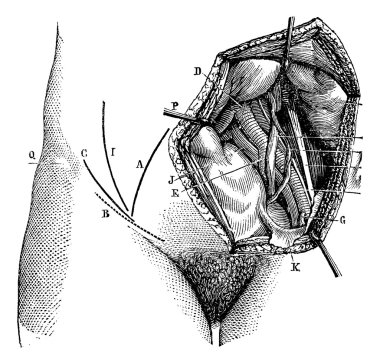 Fig. 618. Iliac artery and its branches, vintage engraving. clipart