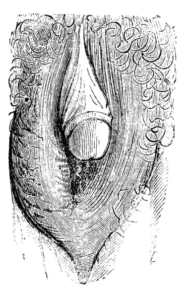 Гипертрофия имитирующей железы человека и может сделать
