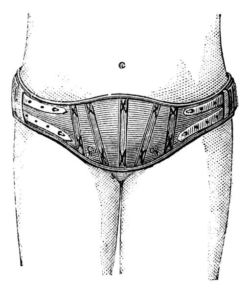 Hypogastric belt, vintage engraving. — Stock Vector