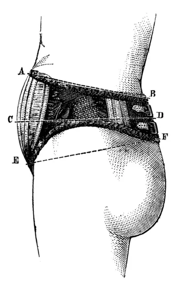 Tissu élastique abdominal anglais, vue latérale, gravure vintage . — Image vectorielle