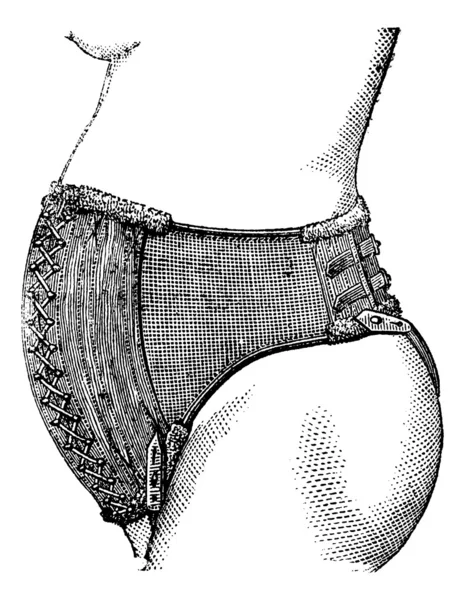 Ceinture abdominale du Dr Pinard, gravure vintage . — Image vectorielle