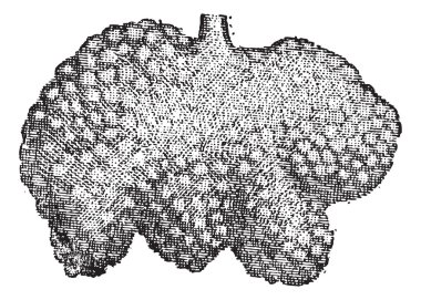 Fig. 4. Intestine, Brunner's glands or duodenal glands, vintage clipart