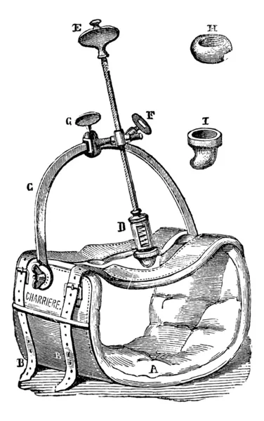 Compresor Nelaton a la aorta, grabado vintage . — Vector de stock